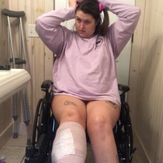 Missi's Wheelchair/Cast/Crutches bundle by Missi Minks